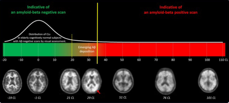 Neuraceq Quantification